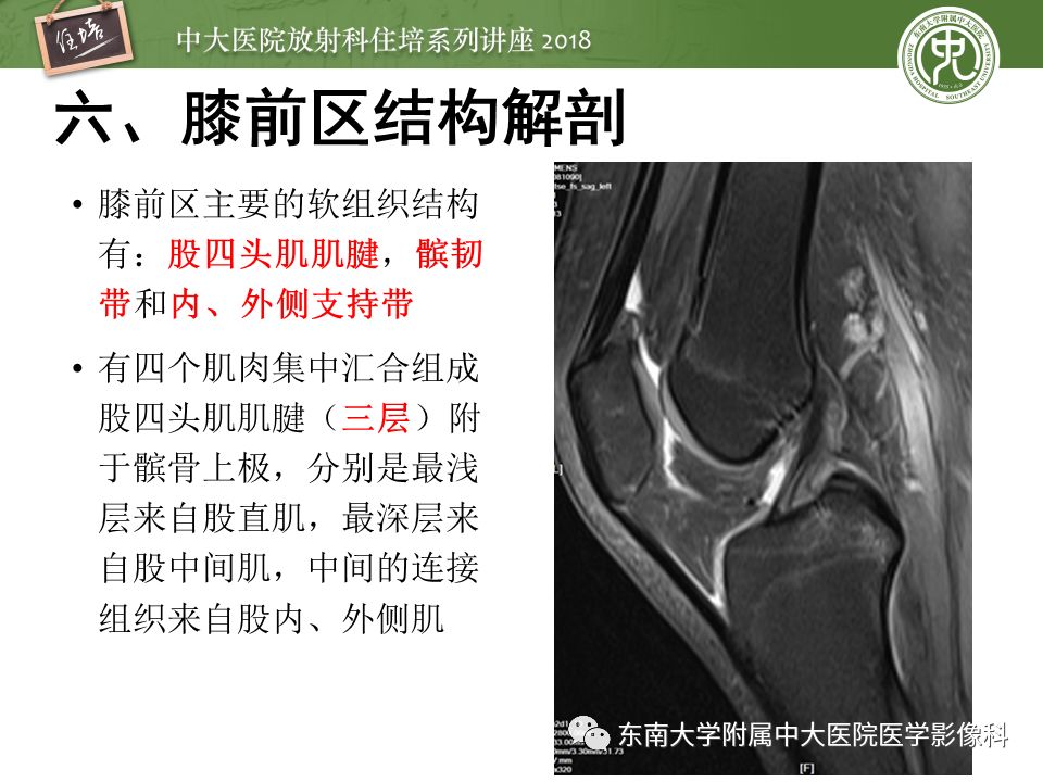 精彩推荐 | 膝关节的正常MR解剖及常见变异